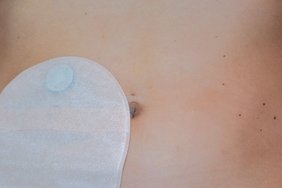 1. Stomatag (Foto: Krankenhaus Barmherzige Brüder Regensburg)